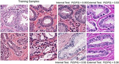 Staining Invariant Features for Improving Generalization of Deep Convolutional Neural Networks in Computational Pathology